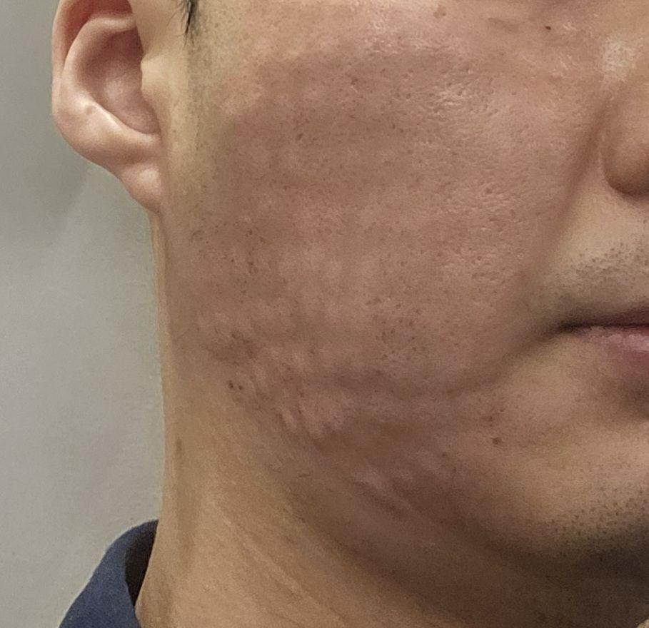 엠보 적절히 올라와서 만족, 주기적으로 받고 있습니다.