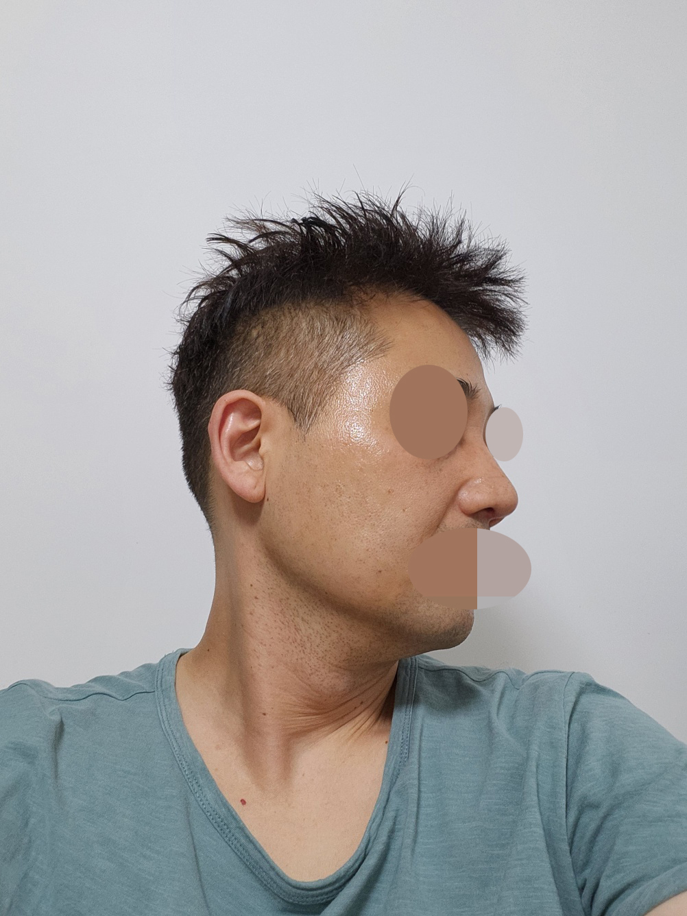 점점 좋아지는게 느껴져요