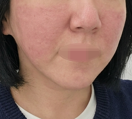 군더더기 없는 상담에 만족스러운 결과까지, 리즈네 강추예요~