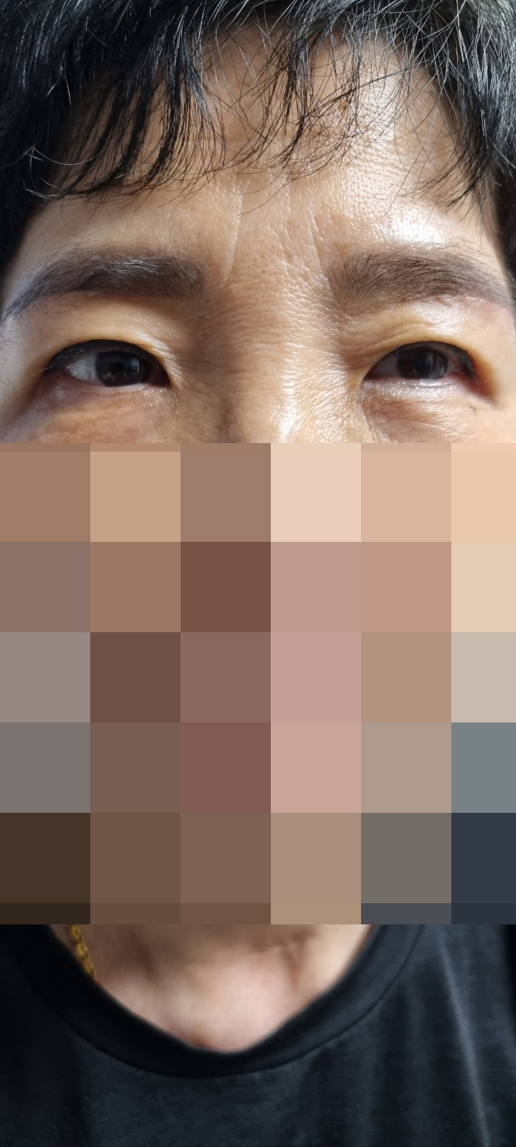 다들 친절하셔서 너무 편안하게 수술 받았습니다!!