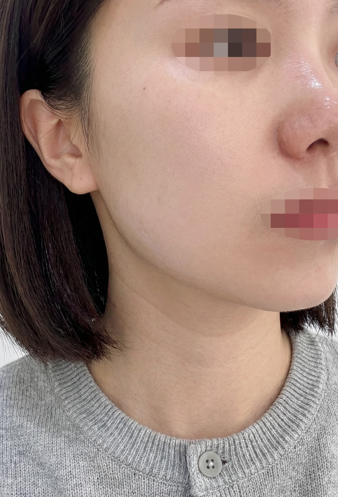 비용도 효과도 만족이라 꾸준히 다닐 것 같아요!