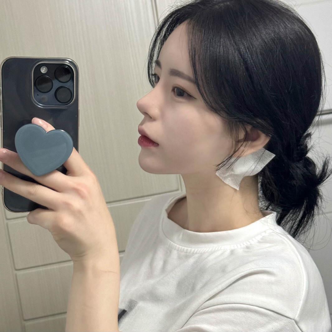 오똑한 코 잘 유지중이에요 ㅎㅎ