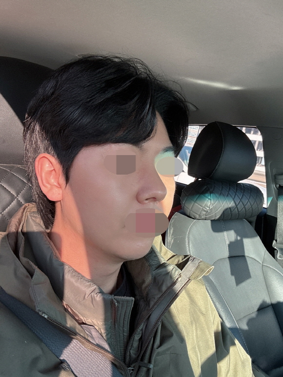 아직 회복중이지만 결과 너무 만족스러워요!