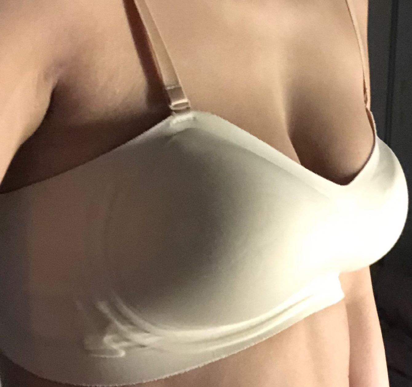 통증이나 붓기 멍도 이제 없구 자연스럽습니다~~