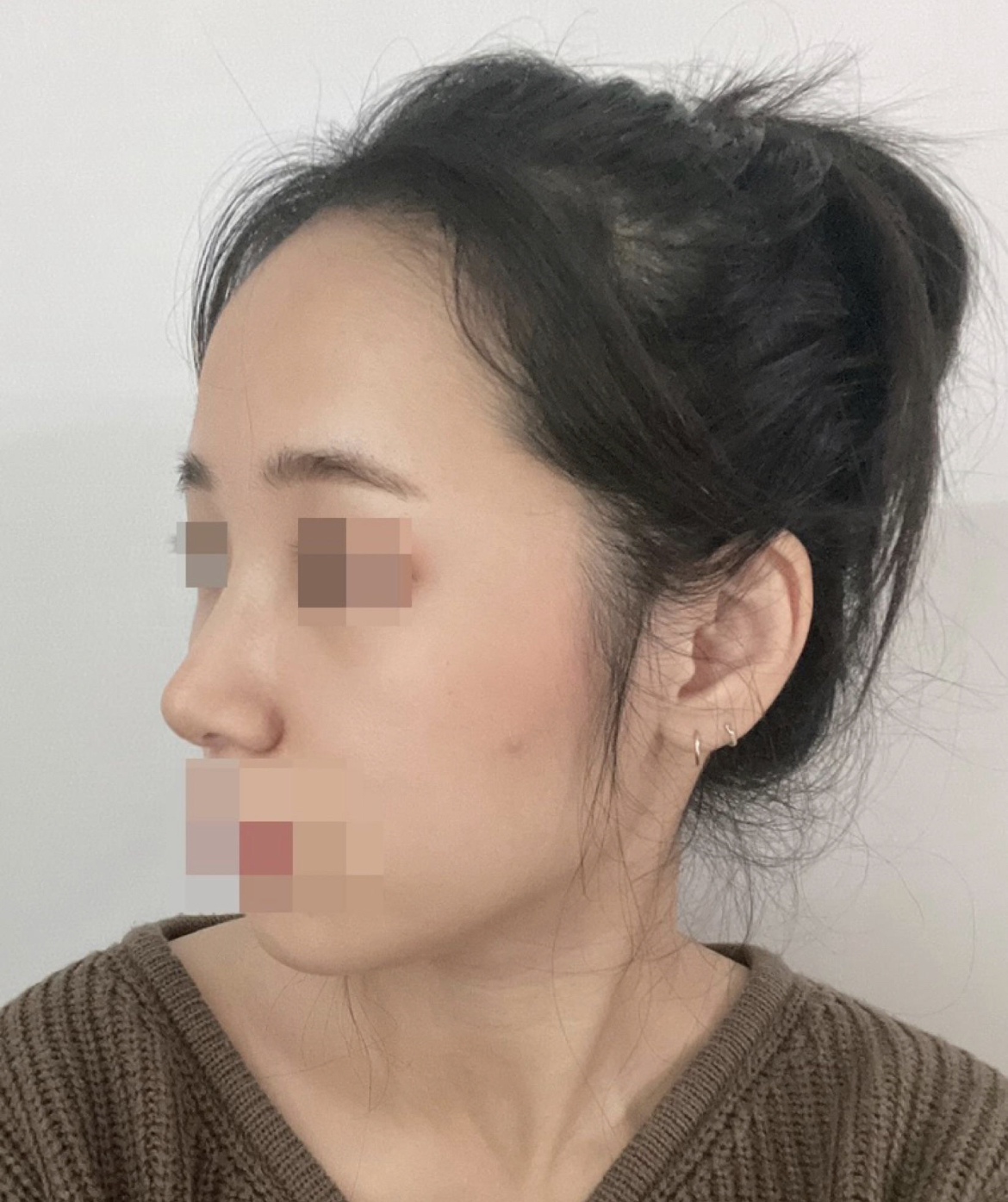 붓기 빠질수록 더 더 마음에 들어요!