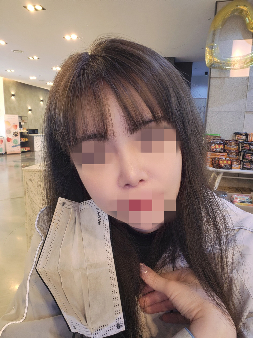 코도 함께 높일 수 있어서 좋았고, 이제 붓기도 많이 빠졌고 모양도 만족스러워요!