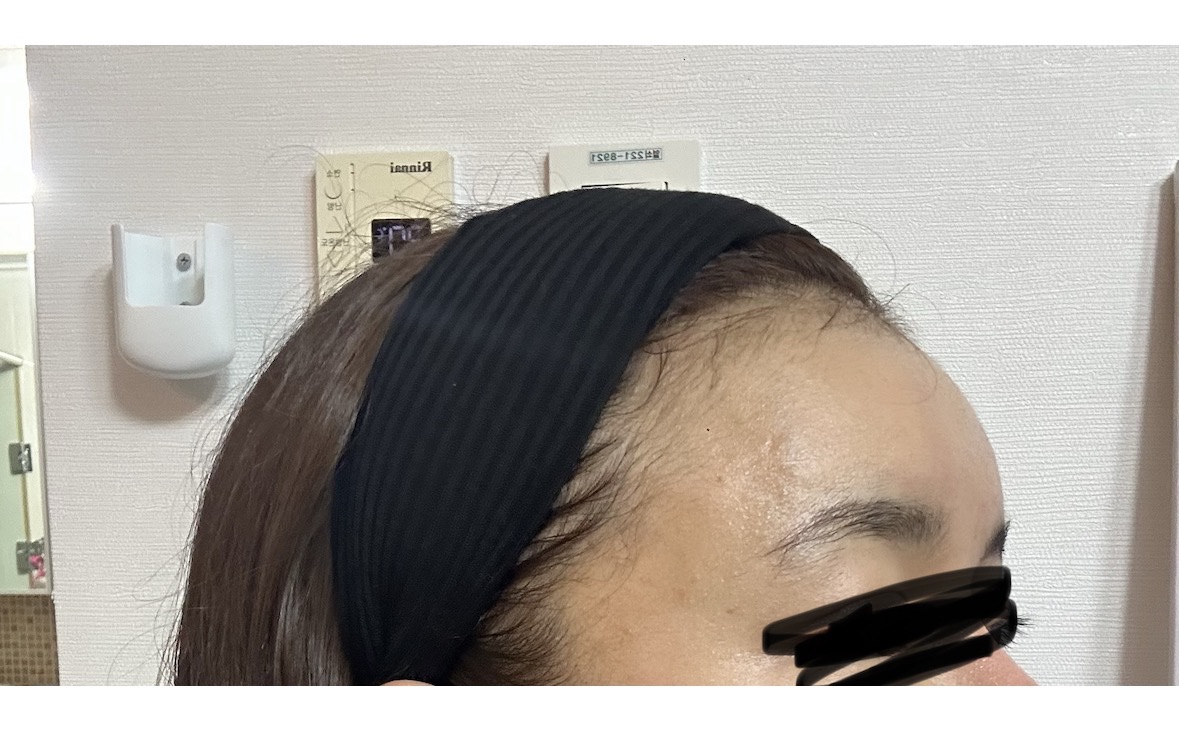잔주름 화장 들뜸 때문에 왔는데 꼼꼼하게 해주셔서 2차 예약했어요ㅎ