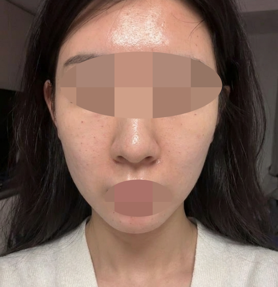 리쥬란 여기서 받았는데 엠보 확실해서 좋은 것 같아요!