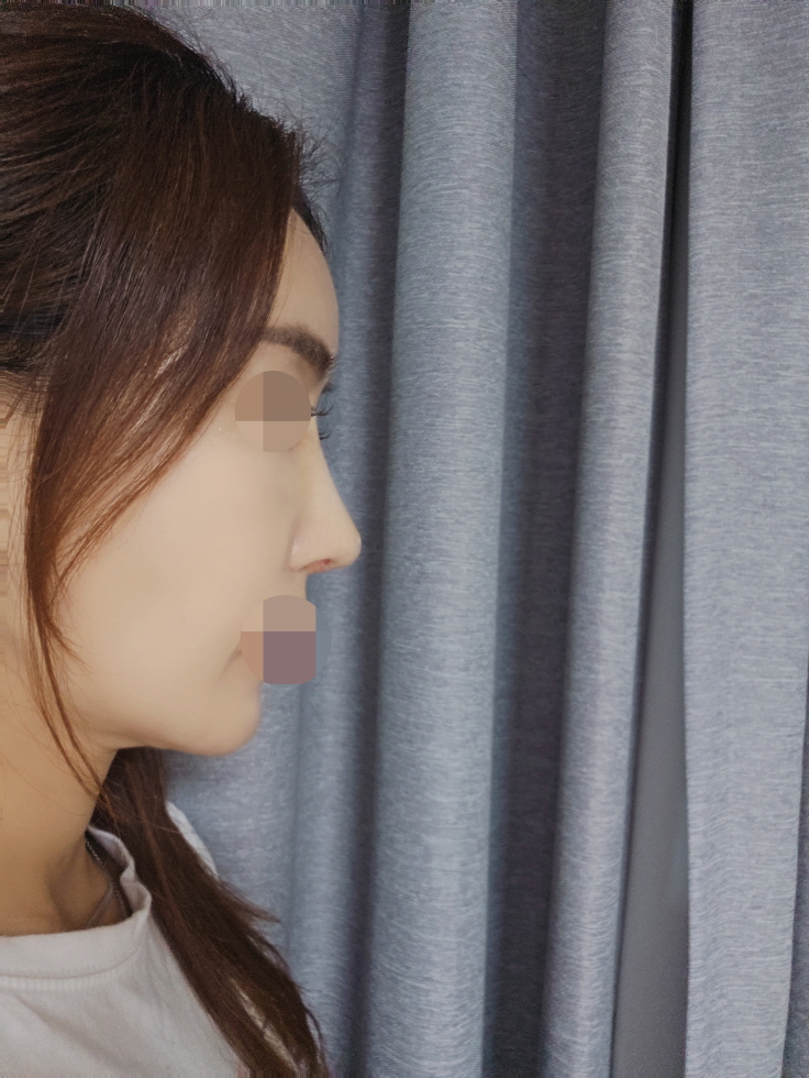 제 코에서 원장님의 정성이 느껴져요 ㅎㅎ