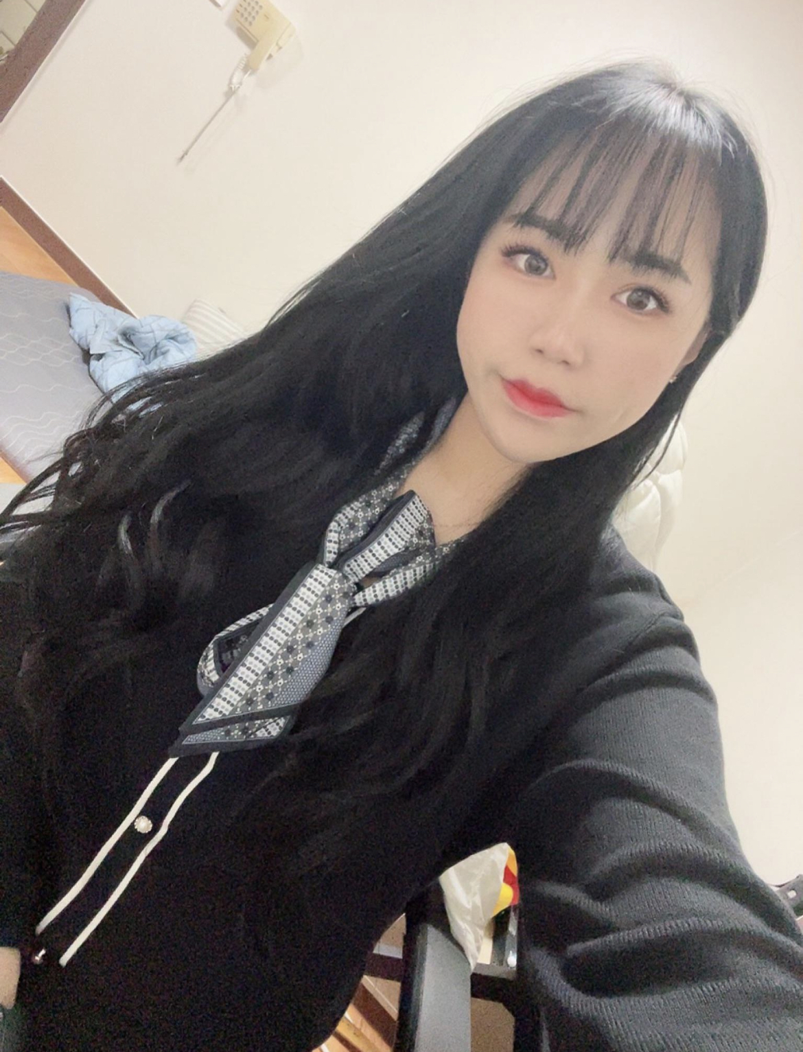 수술 3개월차 입니당 !