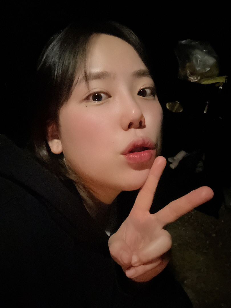 코수술 두달차 붓기도 많이 빠졌고 이물감도 많이 사라졌어용