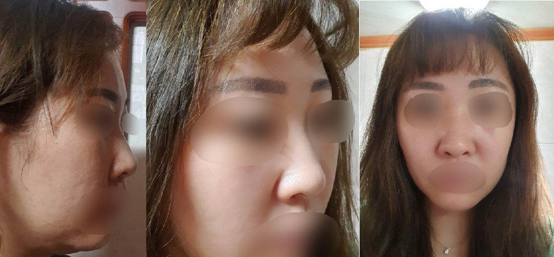 4개월 후기입니다