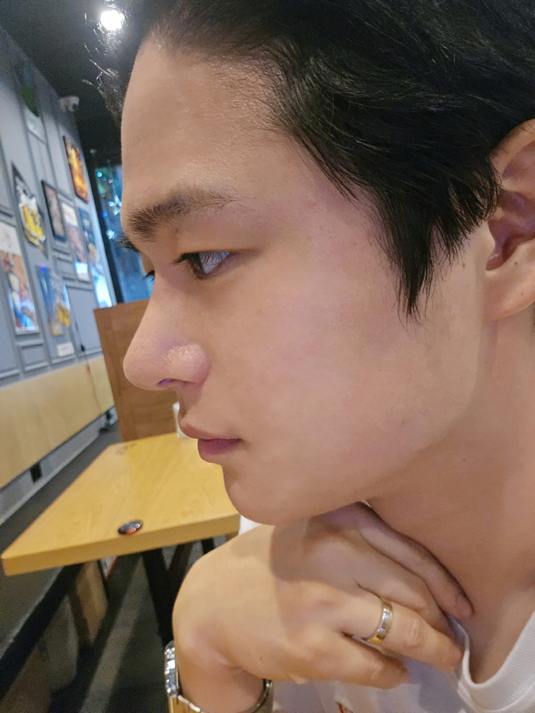 붓기도 이제 거의 안보이고 자리도 잘잡아가는거 같아요 만족합니다