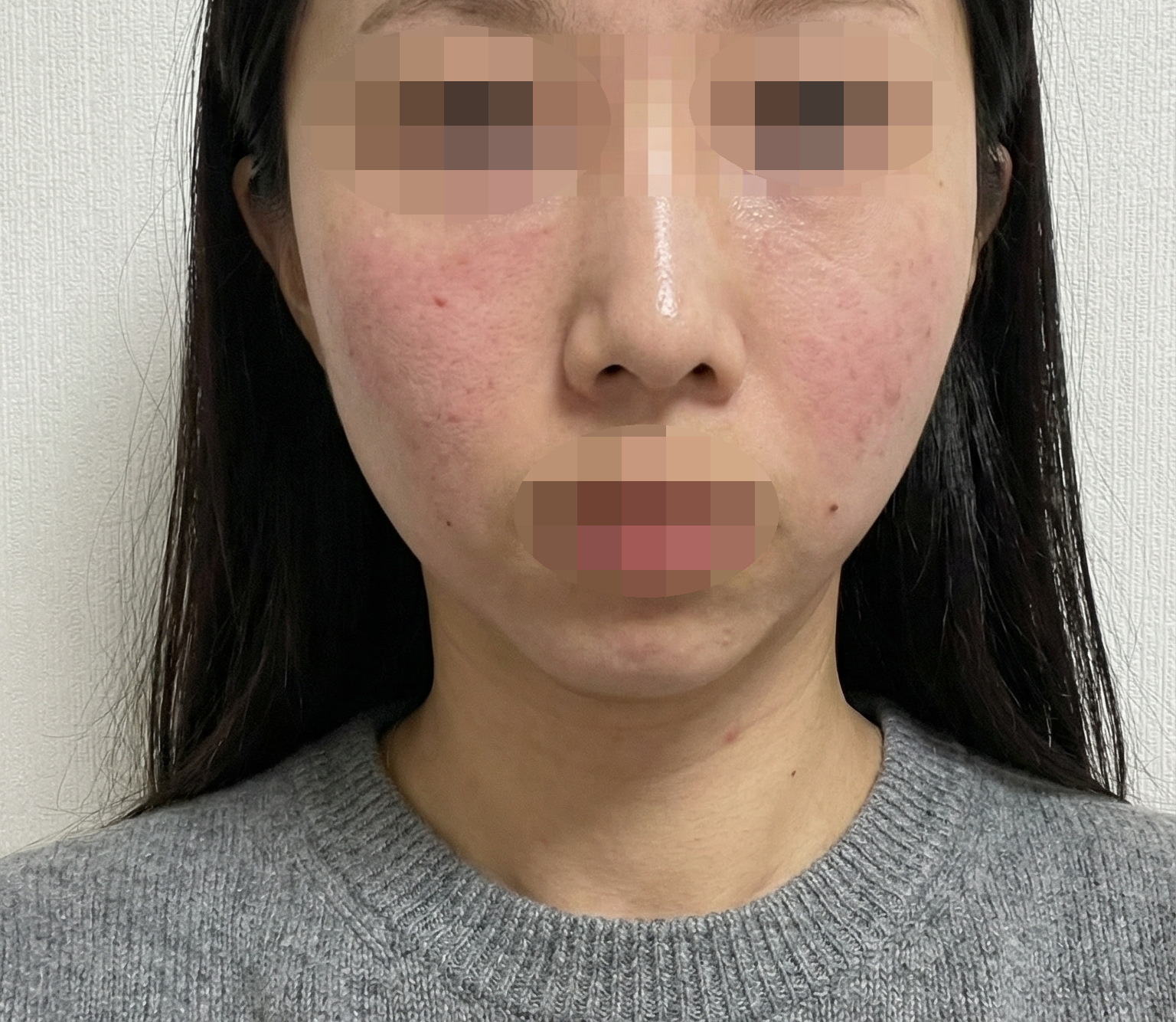 대기 시간도 짧아서 자주 가요~ 그리고 꾸준히 받으니까 효과 보는 것 같아요ㅎㅎ