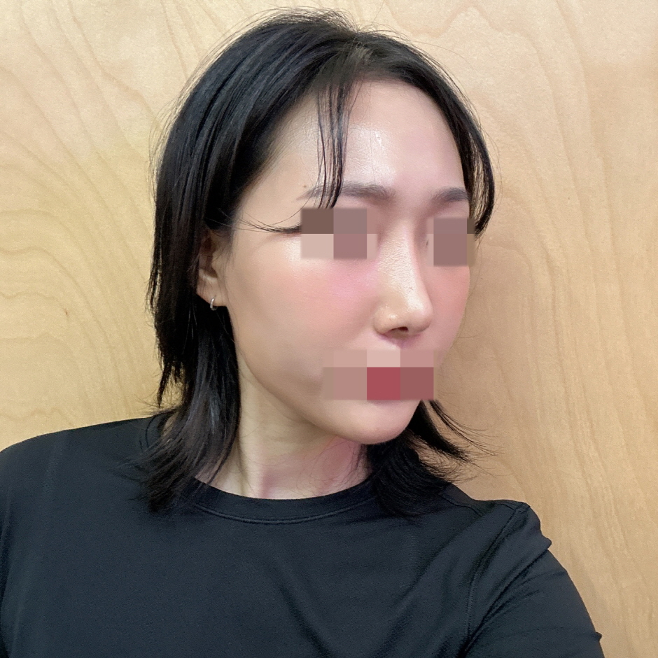 이제 정말 자연스럽게 돼서 제 코 같아요 ㅎㅎ