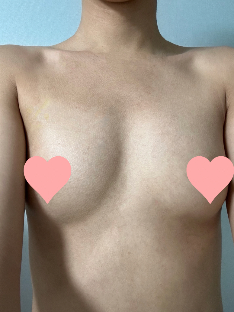 지금은 아직 크기 작아지는 거 없이 만족스러워요