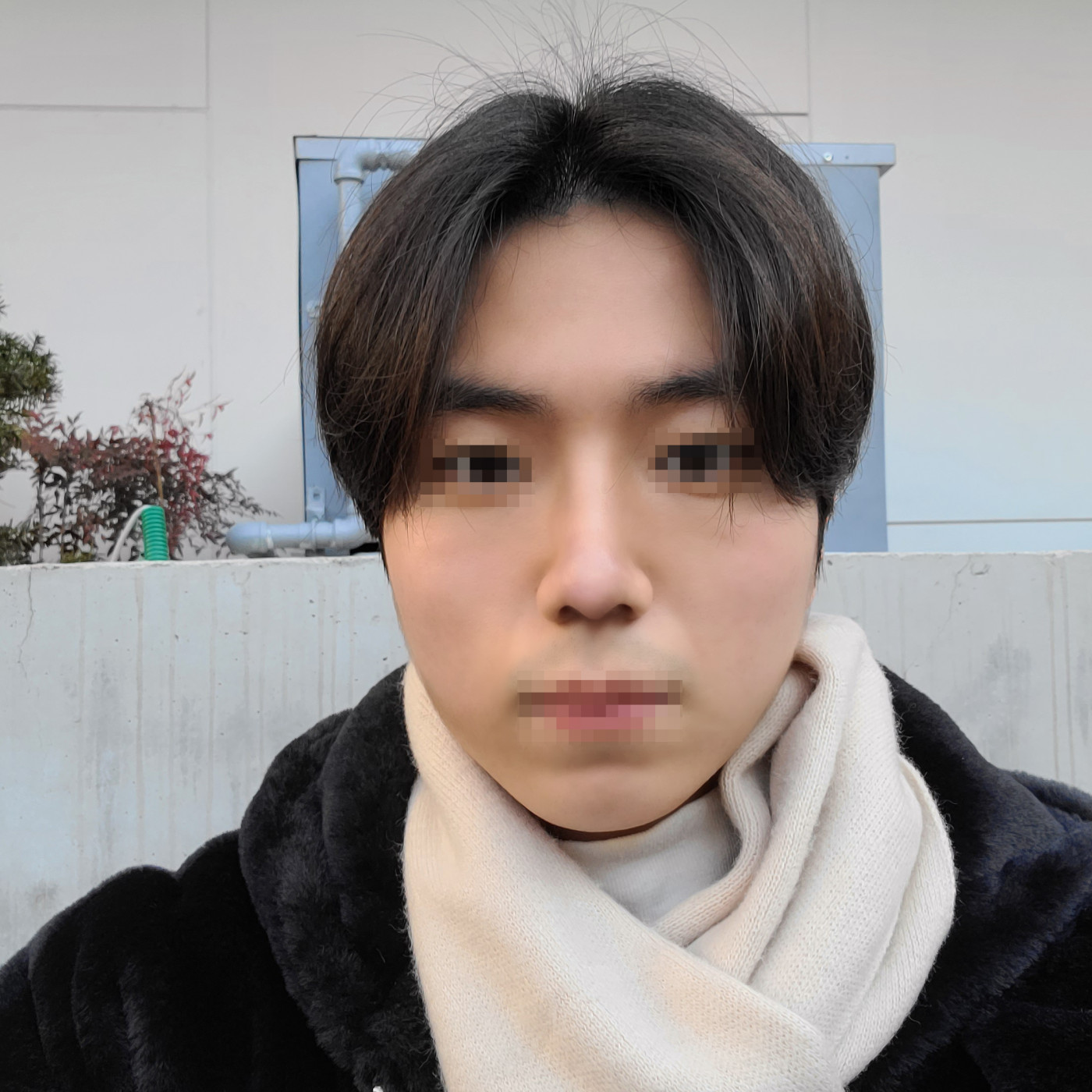 낮은코가 개선되었습니다