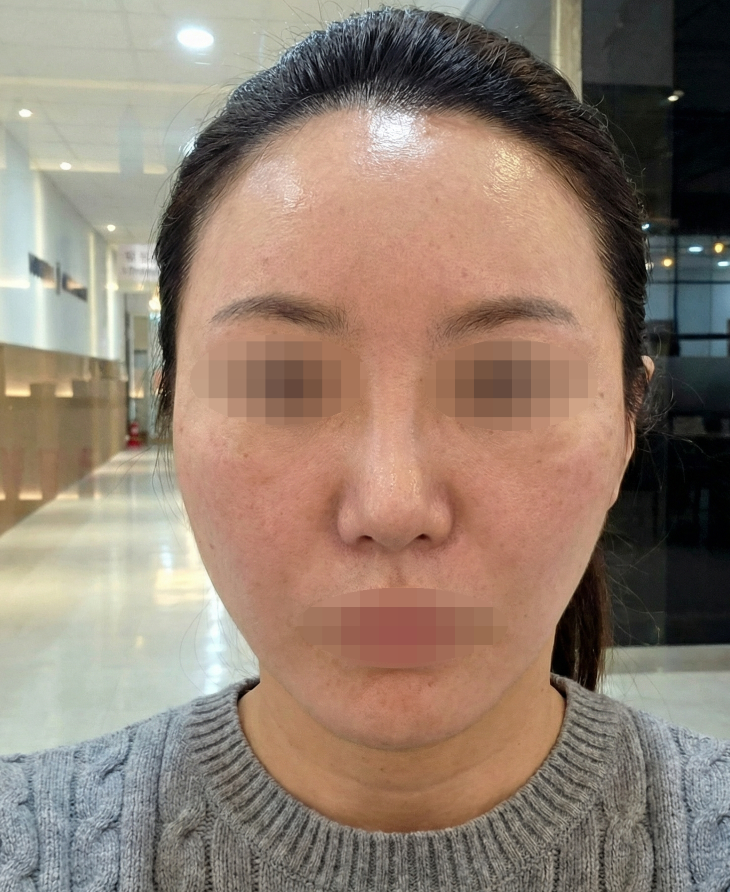 늘 다니는 곳에서 포텐자 받았는데 3회 더 받으려고요~ㅎㅎ