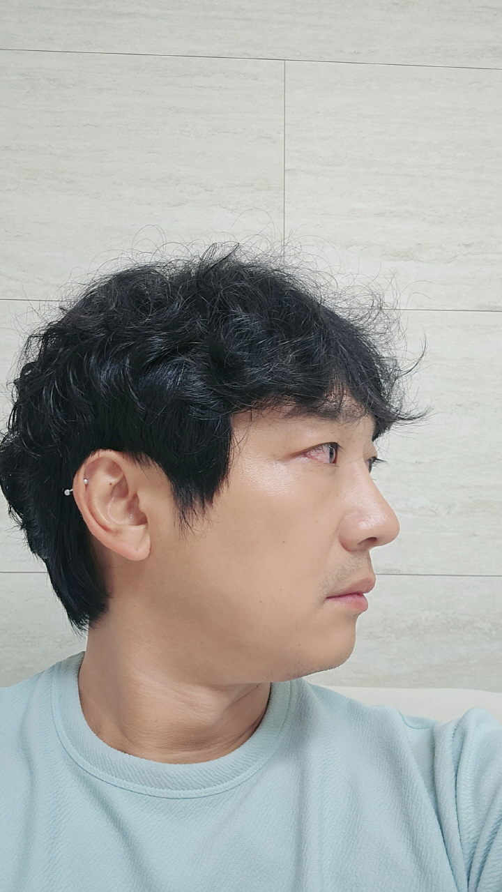 전체적으로 수술은 만족하고 있고 외모에 한층더 자신감도 더 생겼어요
