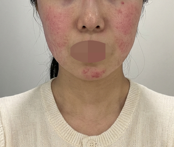 재방문입니다~ 수면으로 동시에 시술들 가능해서 너무 좋아요 ㅎㅎ