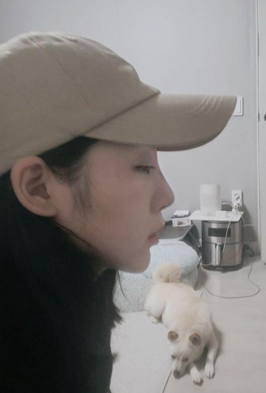 상담 5곳 받고 수술받은 후기