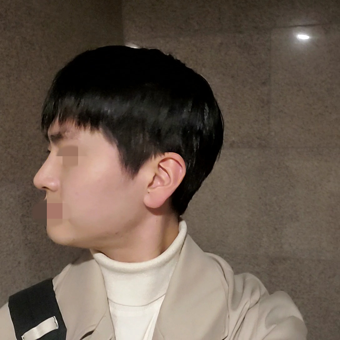 사진 찍는 걸 싫어했고 자존감도 낮았는데 수술하고 3달차 지금 갤러리는 셀카, 제 사진으로 차있어요.