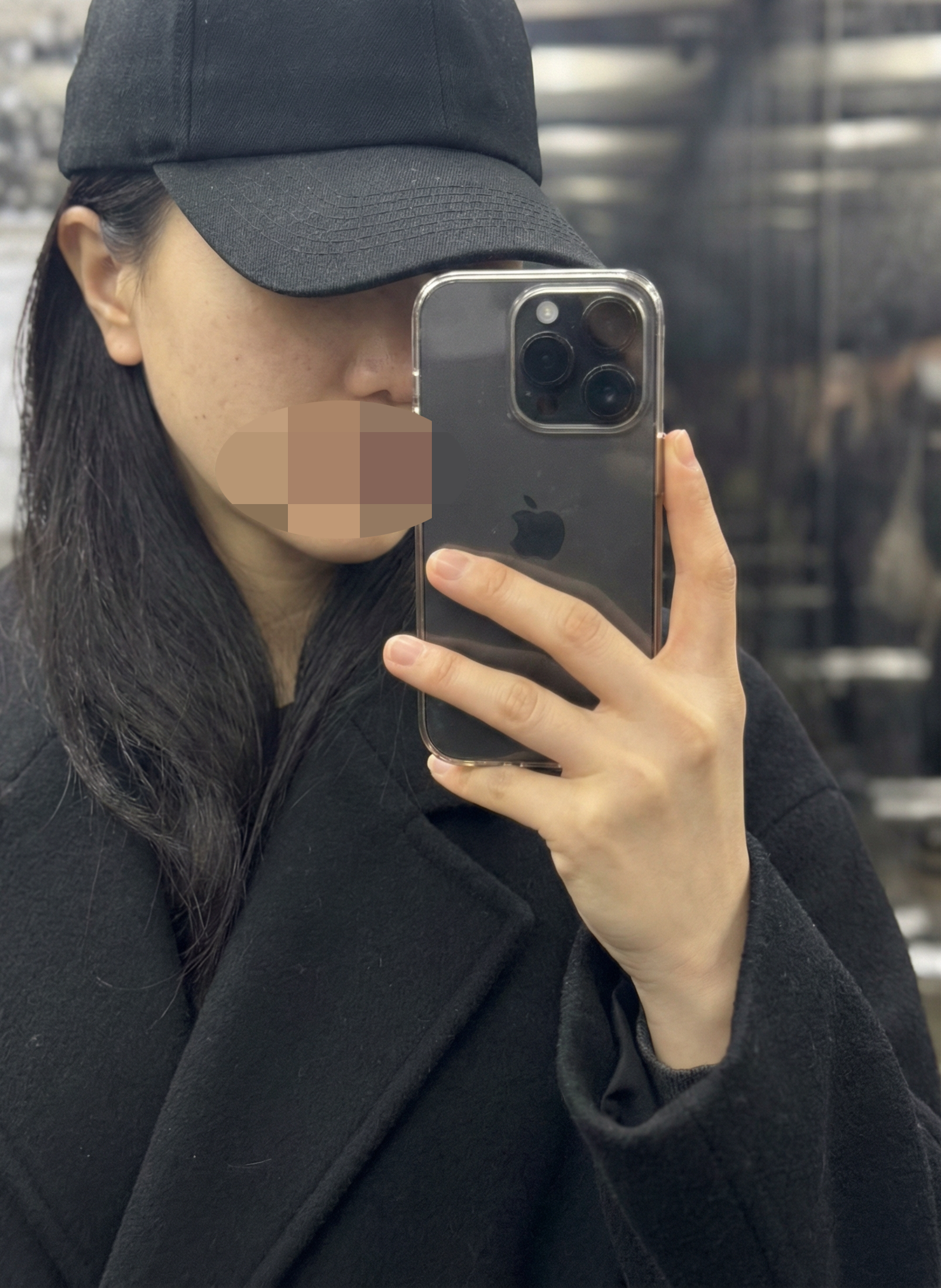 질필러 받아봤는데 다른 시술도 받아보려고요~