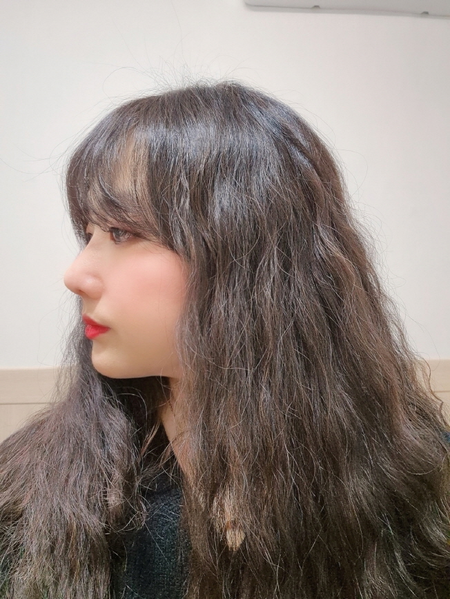 회복 잘 되고 있고 안경도 편하게 쓰고 있어요 ㅎㅎ