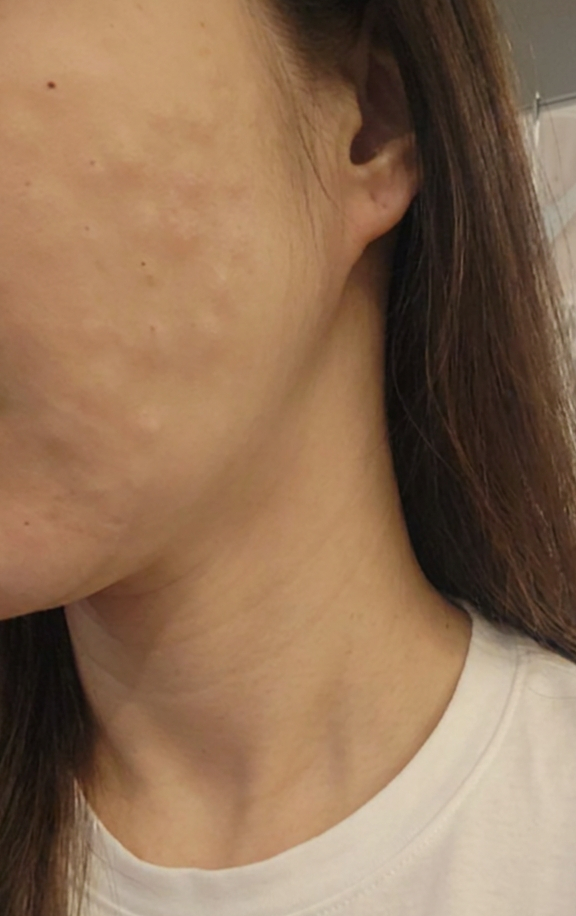 정품 인증까지 챙겨주시는 세심함, 신뢰감 가득해요~수면 진행으로 너무 만족합니다ㅎㅎ