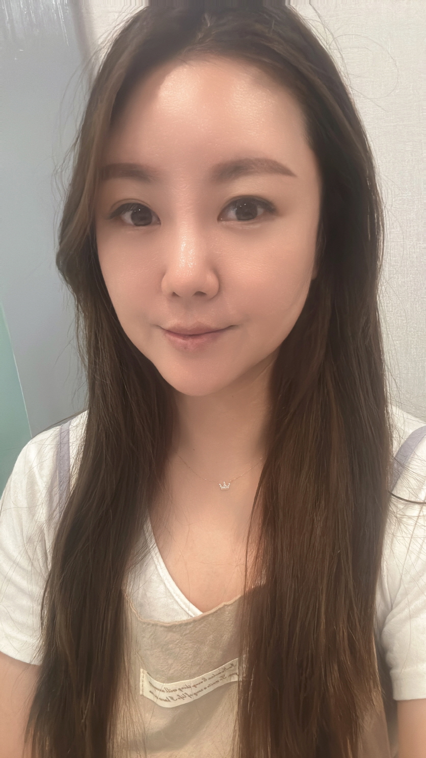 붓기가 빠지면서 콧대가 이뻐졋어요~