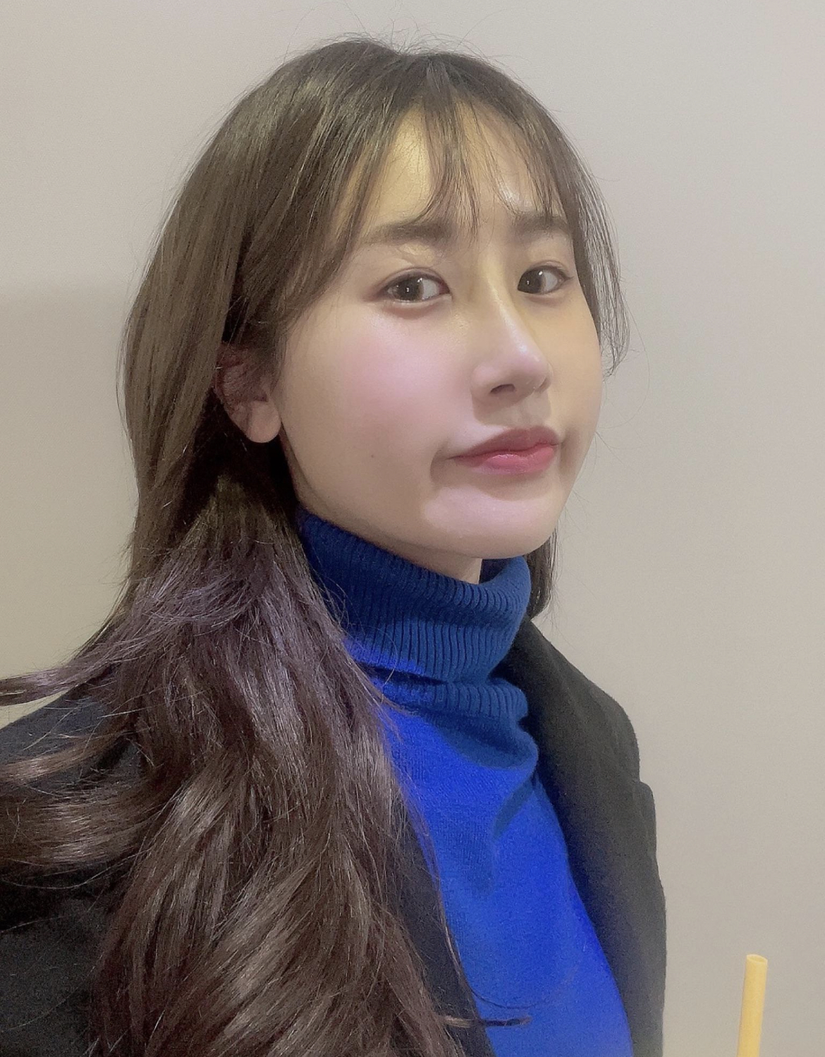 지방러인데 서울까지 온 보람이 있네욤 황원장님 코수술 최고십니다 !