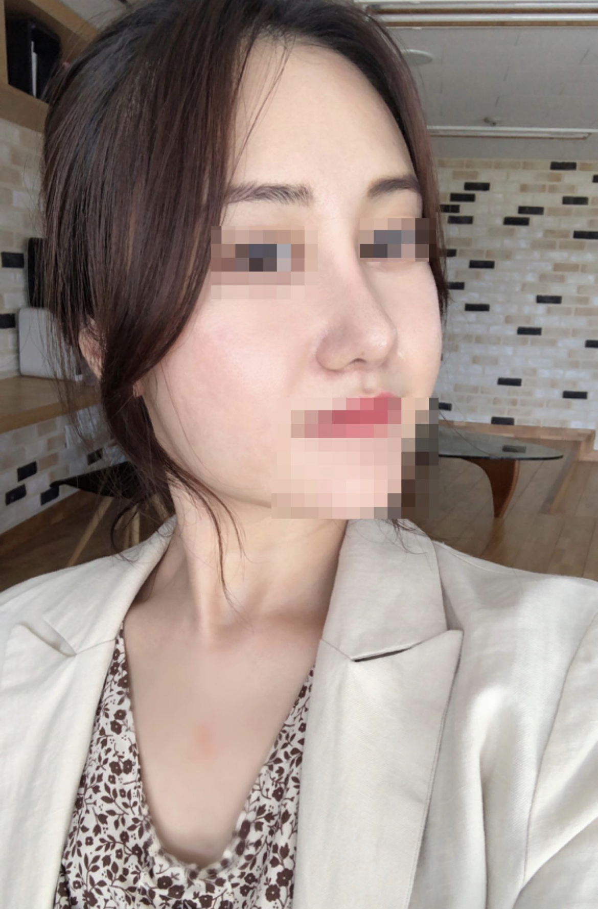 잘된 코에 만족 100% 예전코는 생각도 나지 않아요 ㅎㅎ