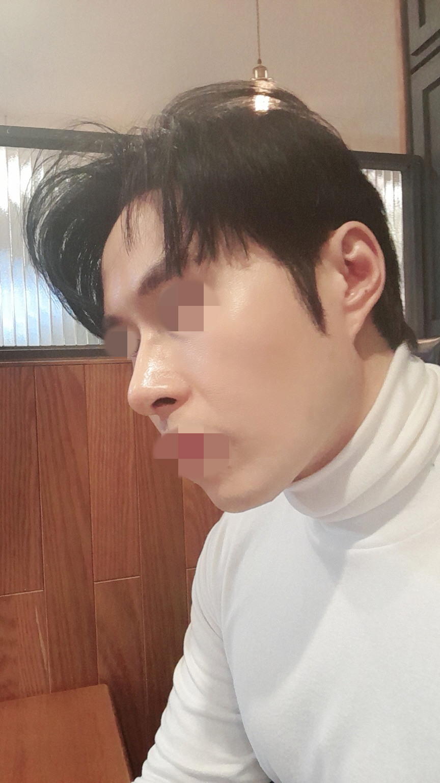 진짜 성형왜하는지 알것같습니다