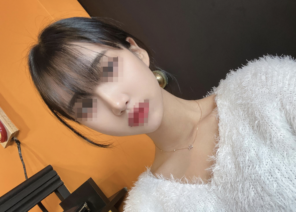 수술한 지 세달이 되었는데 너무 만족하고 있어요