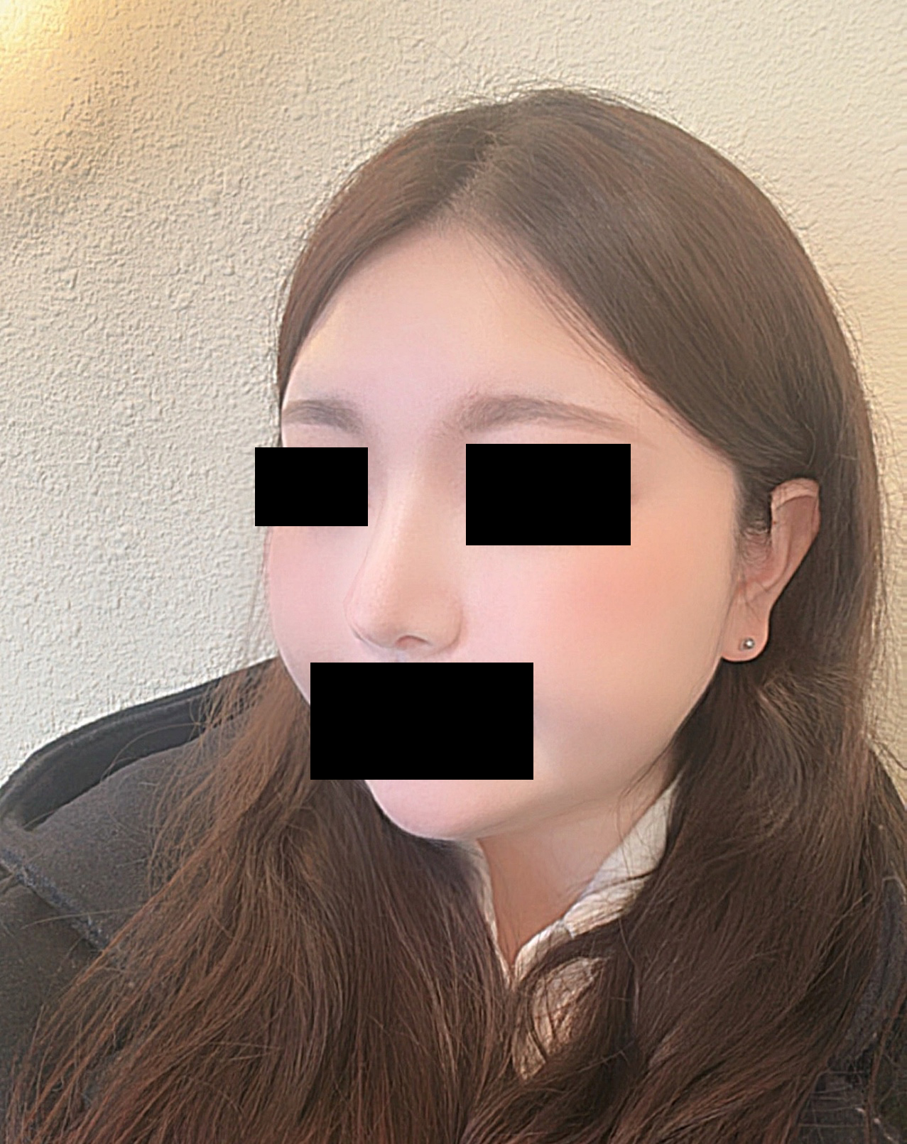 오랜만에 보는 주변사람들이 말안하면 모를정도로 이쁘고 자연스럽게 잘된거 같아요