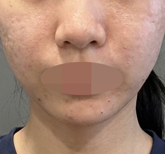 직원분들도 의사 선생님도 꼼꼼하셔서 자꾸만 찾게 되는 곳이에요ㅎㅎ