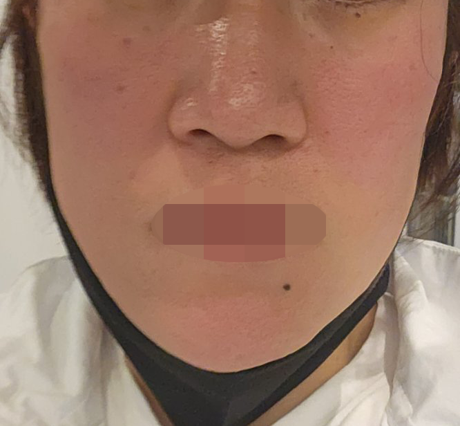 마·미간 주름이랑 속건조 고민으로 방문, 첫날부터 만족스럽게 다녀왔어요!!