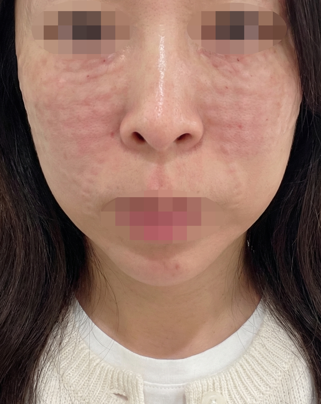 리쥬란 받았는데 친절하고 전문적이라 믿음이 가는 것 같아요~!