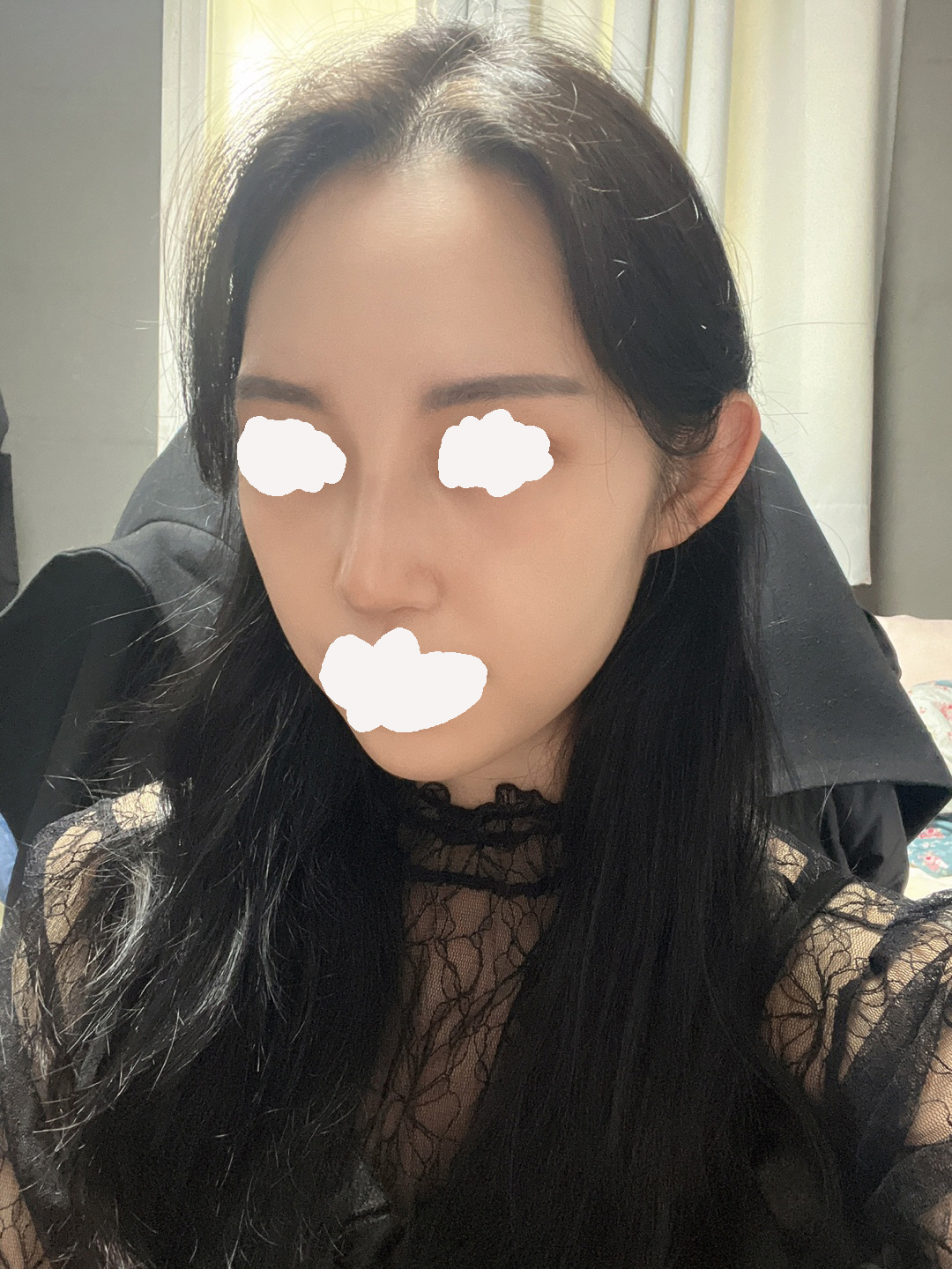 다들 너무 예쁘고 세련되게 잘됬다고 어디서했냐고 하는데 정말 저만알고싶은 병원입니다 ᅲᅲ