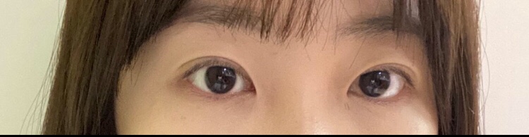 쌍수 한달차입니다 :)