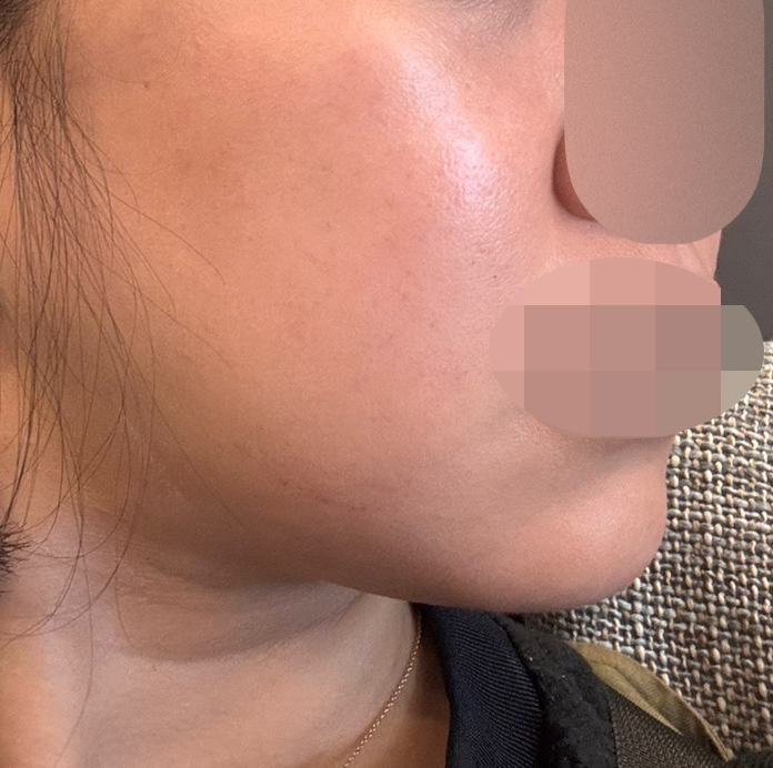 수면이라 편하게 받았고 마스크까지 챙겨줘서 좋았어요!