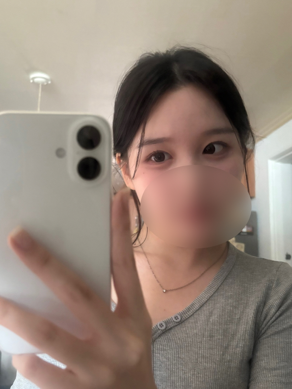 그냥 원래 제 눈인것처럼 흉터도 아예 없고 불편하지도 않고 이뻐요!!