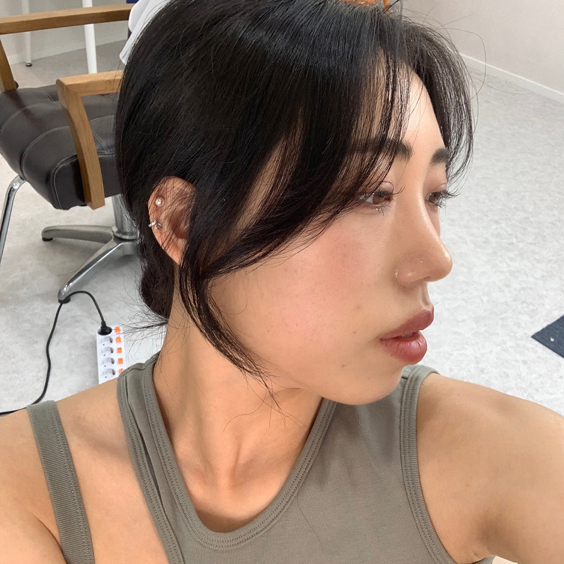 서울아이성형외과에서 하길 진짜 잘한거같아요