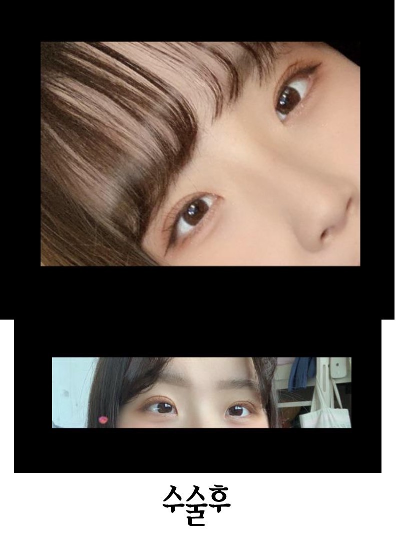 자연유착후기