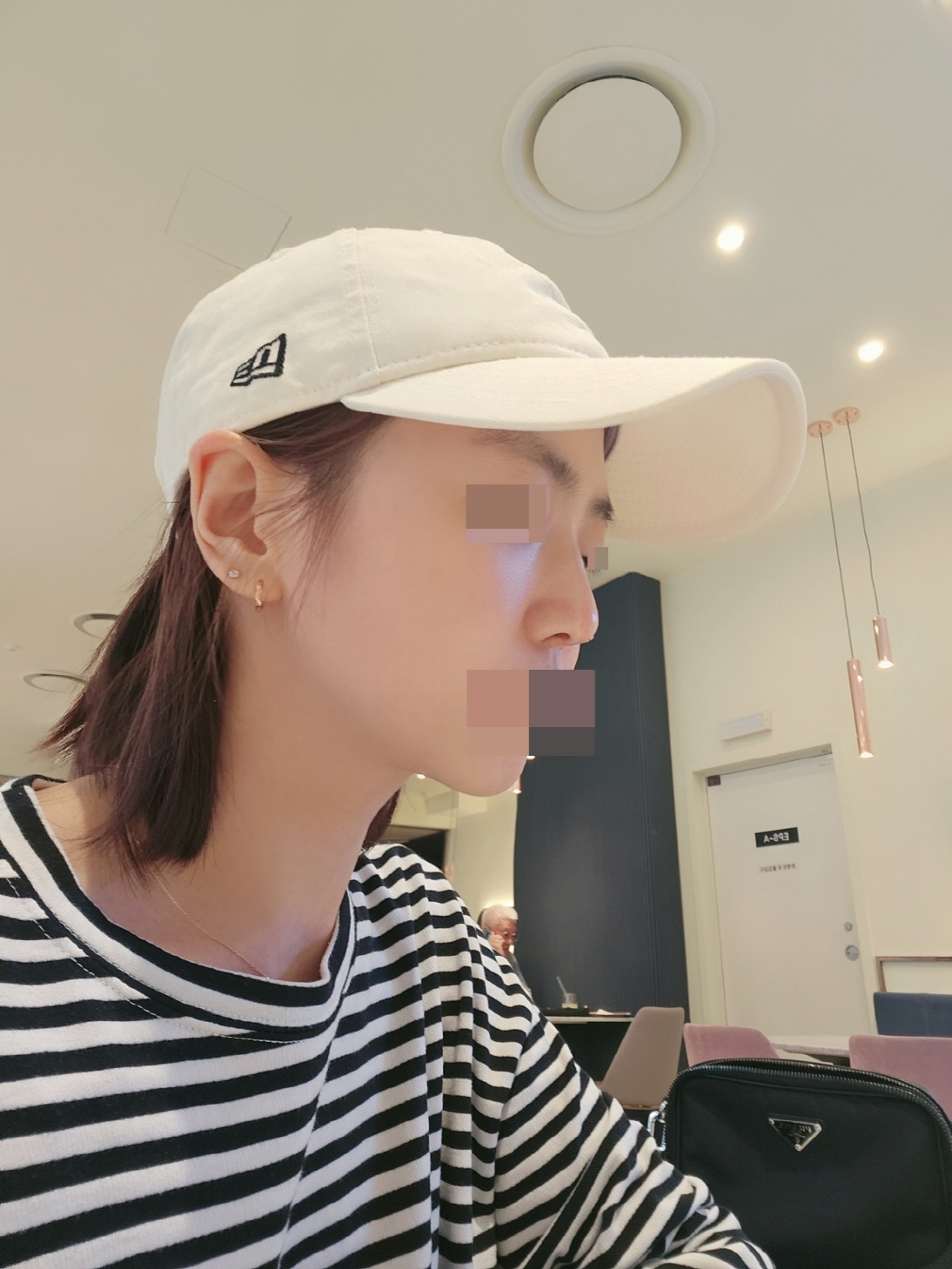 보는 지인들마다 너무 자연스럽다며 어디서 했냐고들 물어봐요