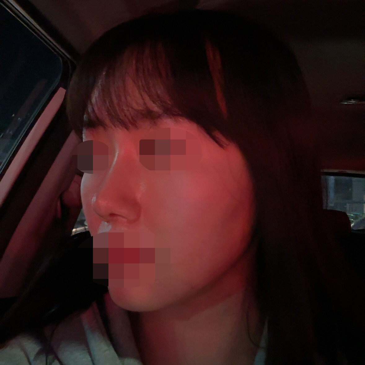 친구들도 자연스럽게 잘됐다고 다들 병원 어딘지 물어봐요ㅋㅋㅋ
