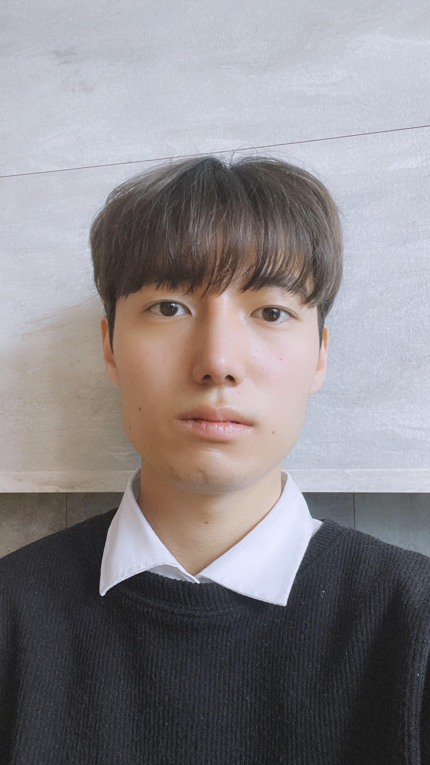 첨보다 엄청 자연스러워지고 지인들이 수술한지 모를정도 입니당