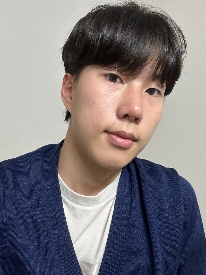 황정일 원장님께서 자세히 설명해주셔서 마음이 많이 편했어요. 남성분들 티 안 나게 예뻐지시려면 코 끝 수술 강추드립니다 ᄒᄒ