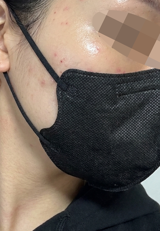스태프분들 친절함에 통역까지 완벽해서 다음에도 꼭 다시 오려고요ㅎㅎ