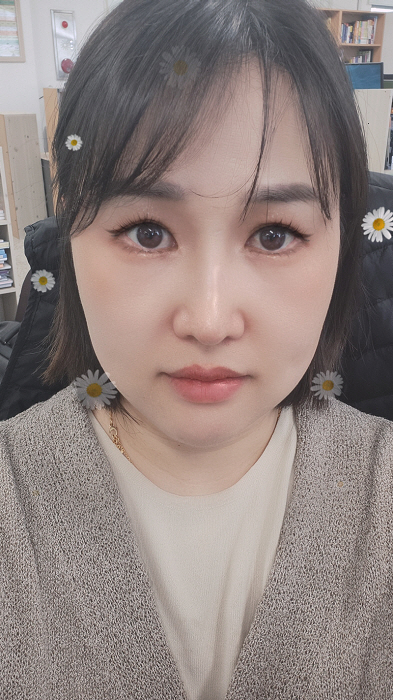 서울아이성형외과 황원장님 정말 친절하십니다